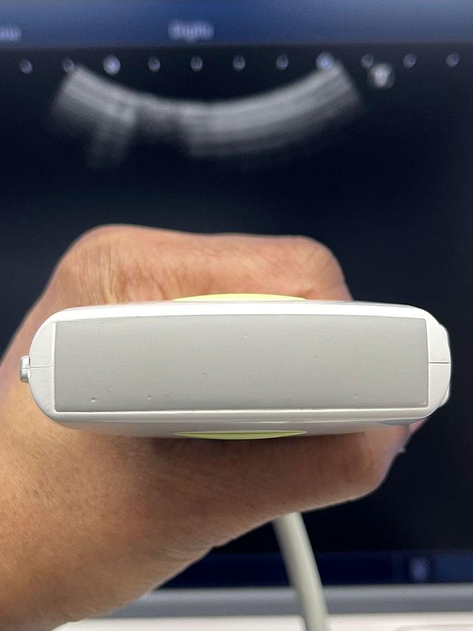 Used Toshiba Ultrasound Aplio 500 YOM: 2015