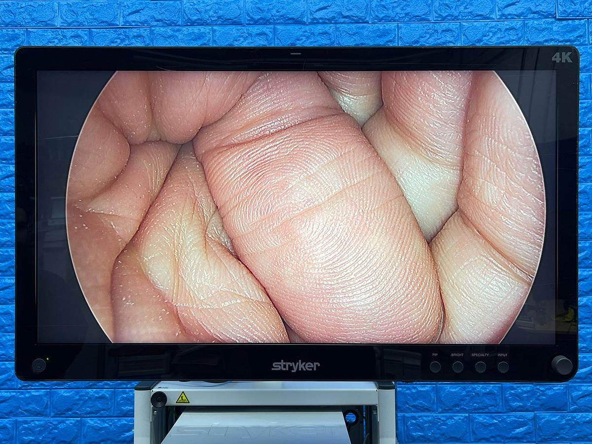 Used Stryker 1588 Laparoscopy Tower - Stryker 1588 Laparoscopy Tower  - Stryker Led Monitor 32 inch 4K YOM: 2016 - Pneumo Care - Synk Wireless Transmitter  - 1588 HD Camera Head  - SDC3 HD Information Management YOM: 2013 - 1588 HD Image Processor YOM: 2016 - LIO LED Light Source YOM: 2016 - SDP 1000 Digital Colour Printer