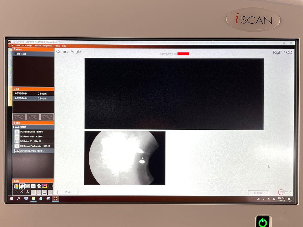 Used OPTOVUE IVUE 500 YOM: 2021 OCT