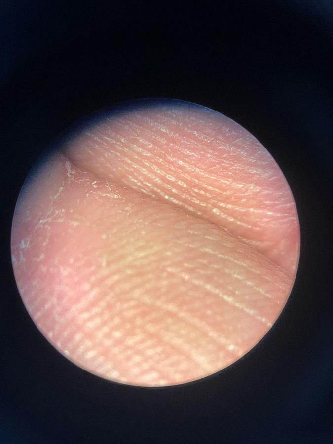 Used ZEISS S7 OPMI Movena Microscope YOM: 2009