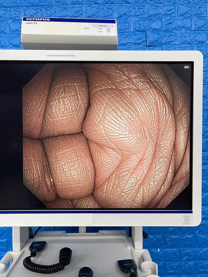 Used Olympus Scope Model: GIF -HQ290 