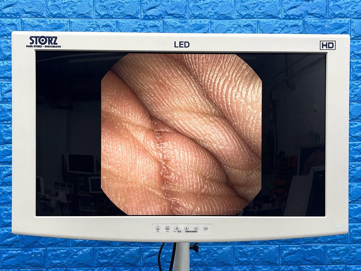 Used Karl Storz Scope Model: 11272 VH