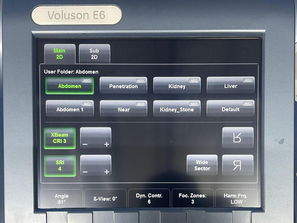 Used GE Datex Ohmeda Voluson E6 Ultrasound YOM: 2015 Probes RAB6-D YOM: 2015 IC5-9-D YOM: 2015