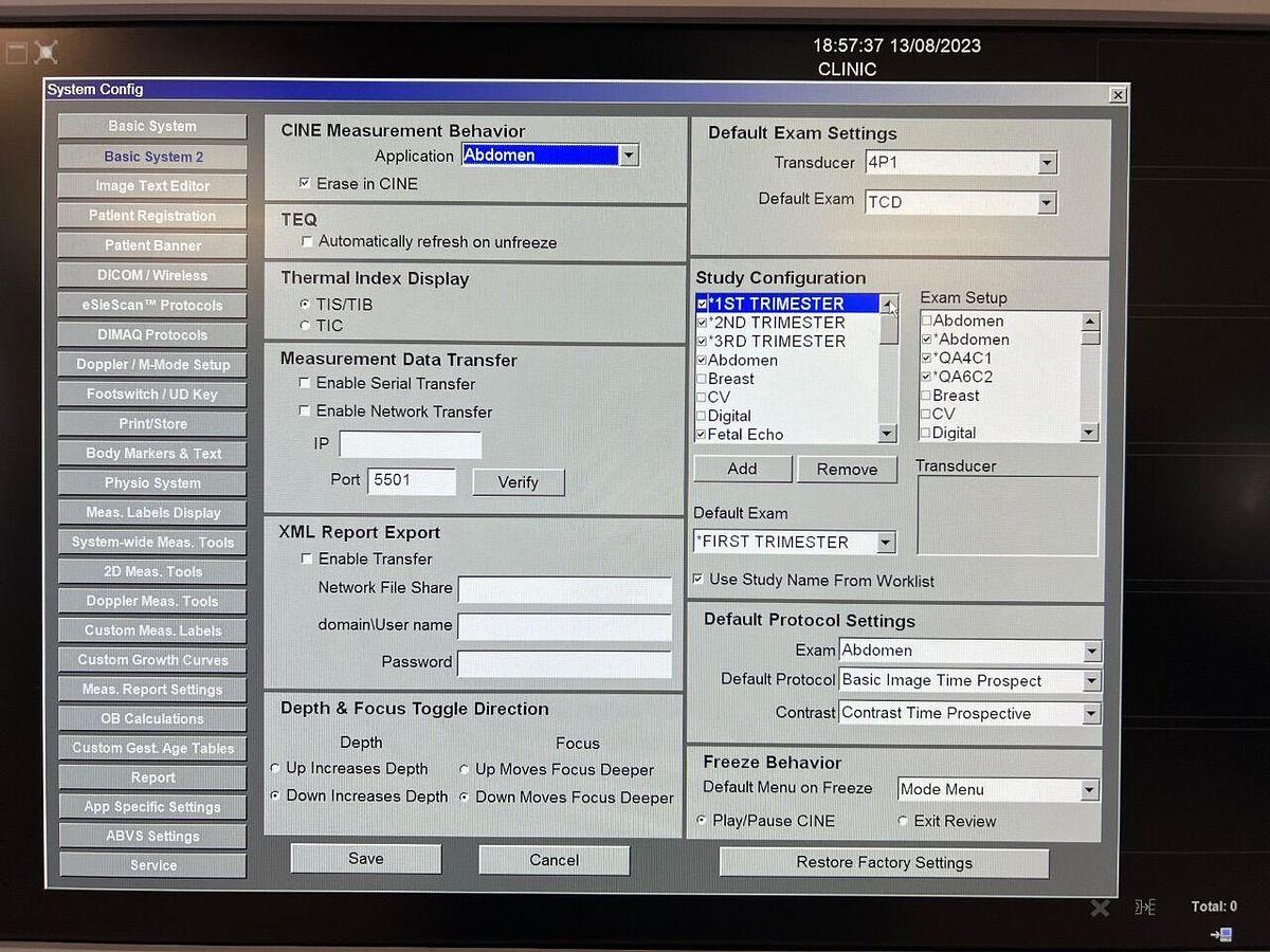 Used ACUSON/SIEMENS S1000 YOM