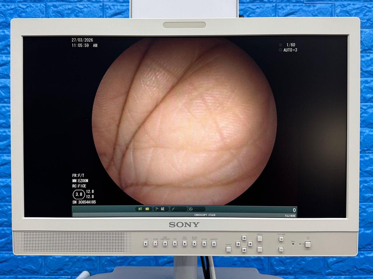 Used Fujinon Scope Model: EC-530FL 