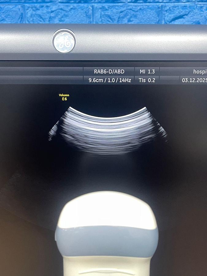 Used GE Datex Ohmeda Voluson E6 Ultrasound YOM: 2015 Probes RAB6-D YOM: 2015 IC5-9-D YOM: 2015