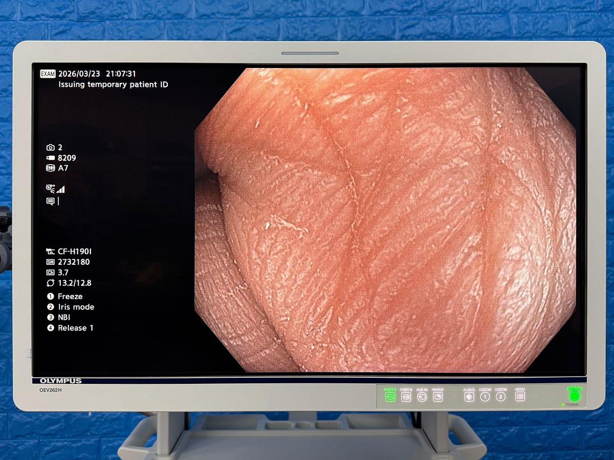 Used Olympus Scope Model: CF-H190I