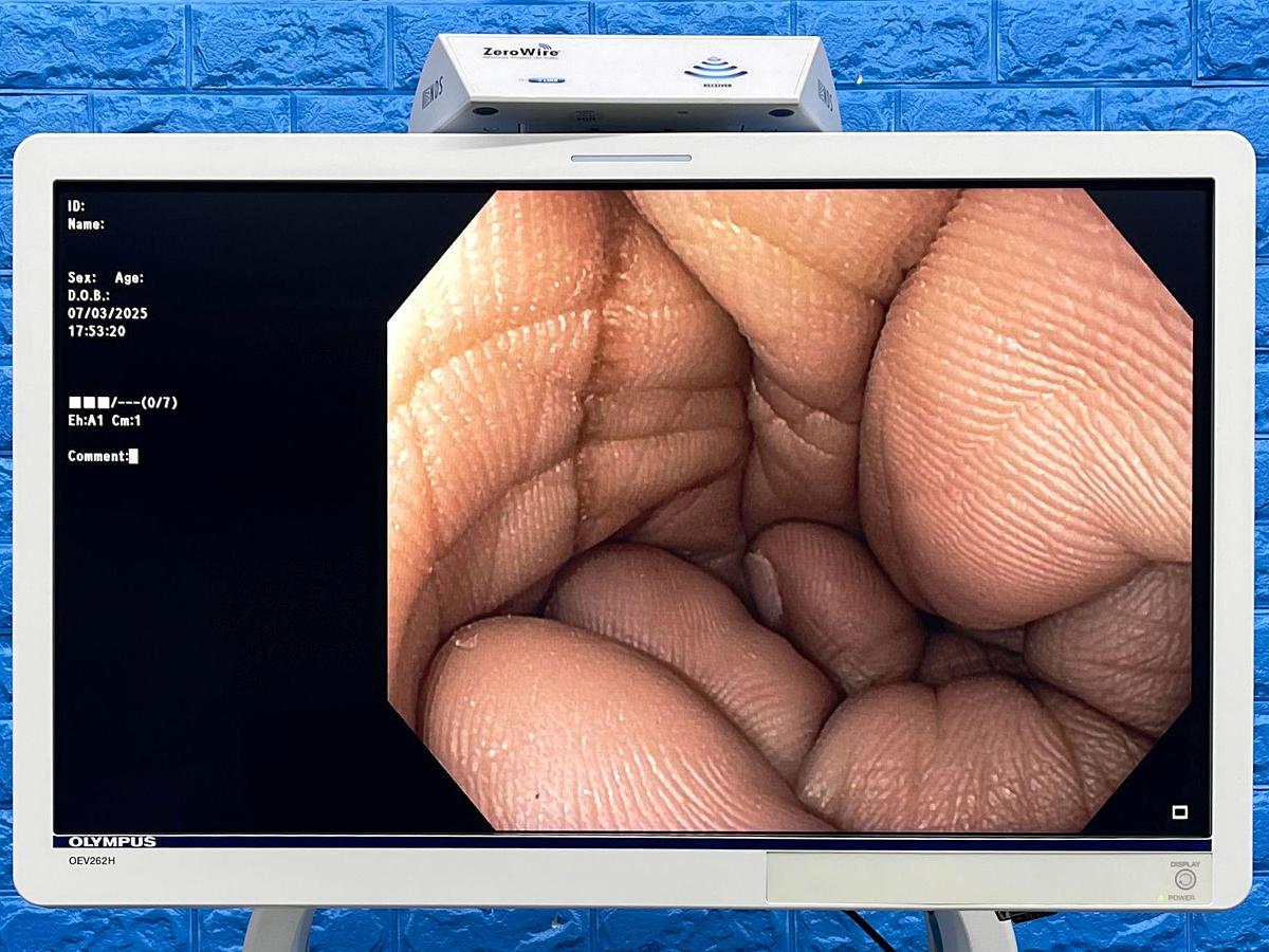 Used Olympus System Evis Exera III, Model: CV-190