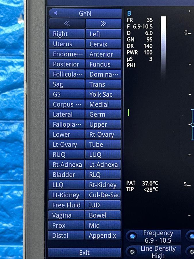 Used Sonoscape X3 Ultrasound YOM: 2019