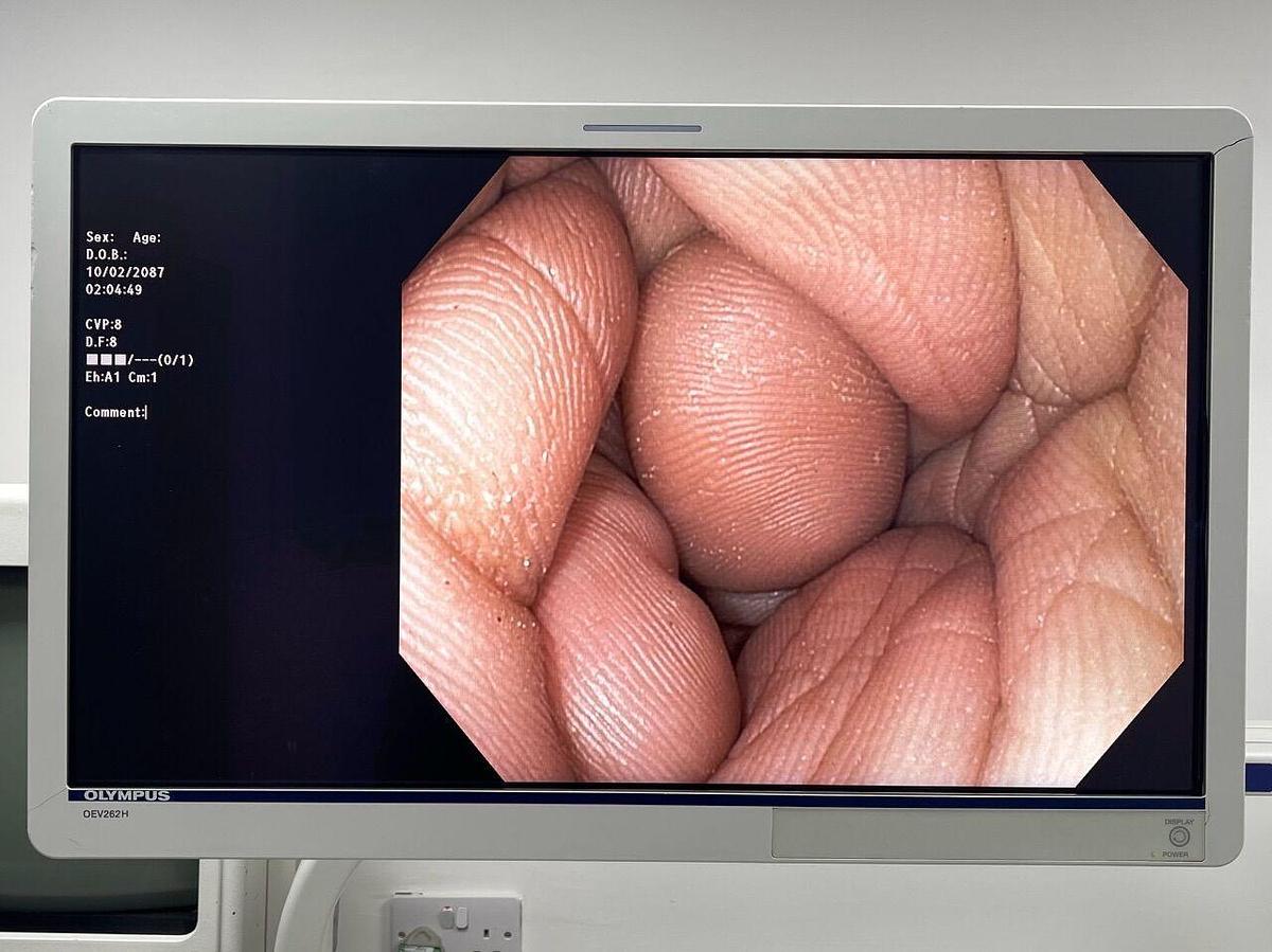 Used OLYMPUS Scope GIF-1TH190