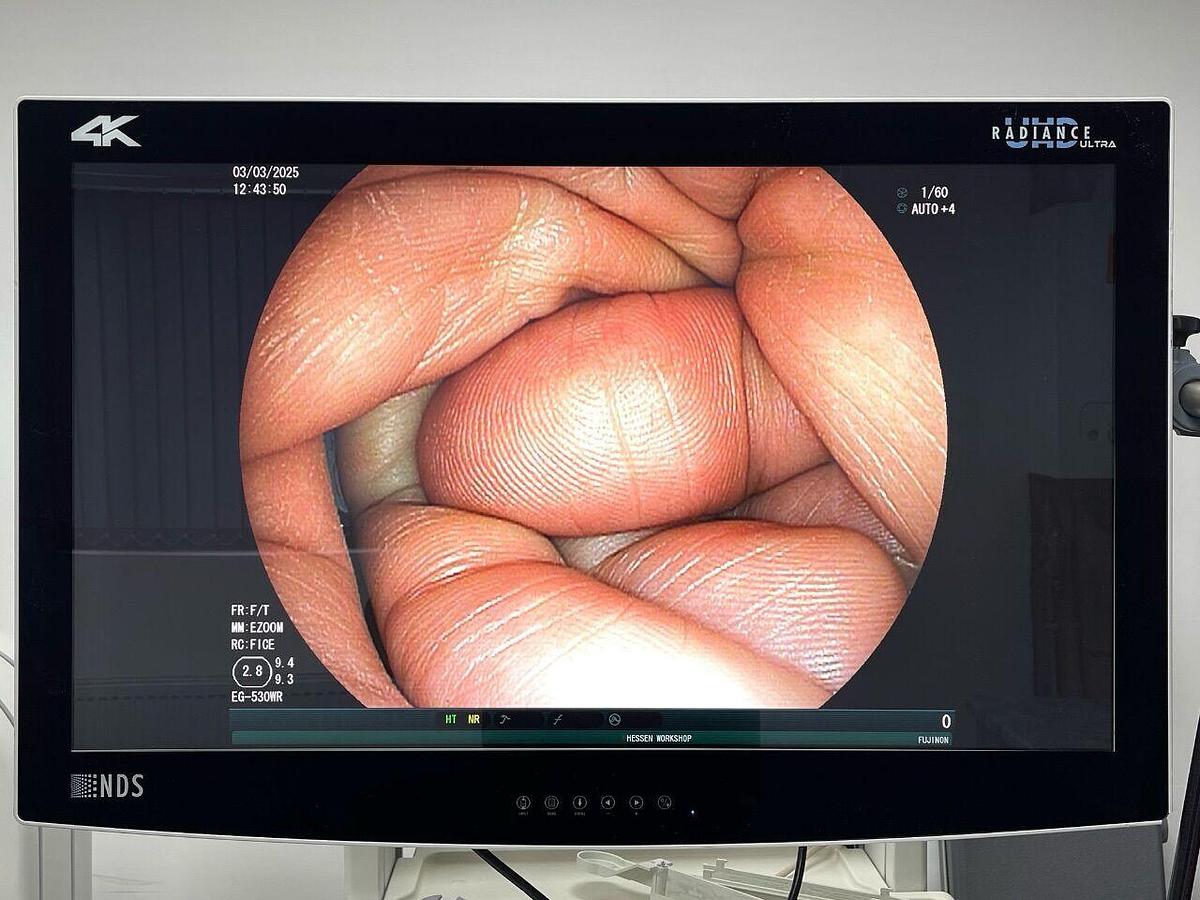 Used FUJINON Scope Model