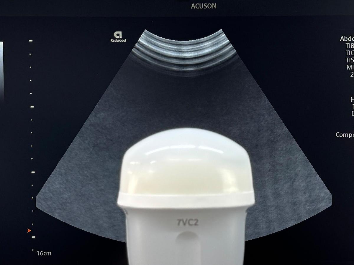 Used Siemens Acuson Redwood Diagnostic Ultrasound REF: 11503314 YOM: 2022 Probes 9C3 YOM: 2025 7VC2 YOM: 2021 9EC4 YOM: 2022
