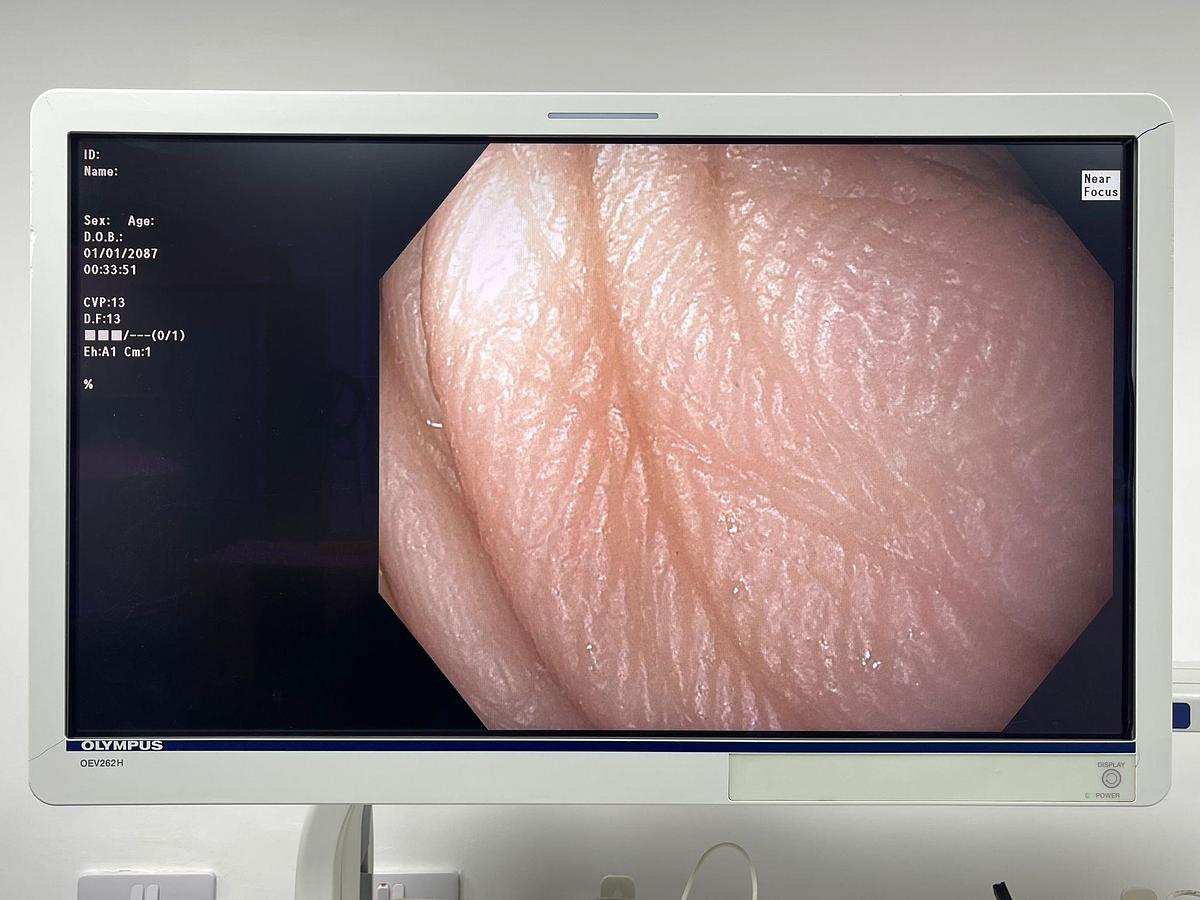 Used Olympus Scope Model: GIF-HQ190