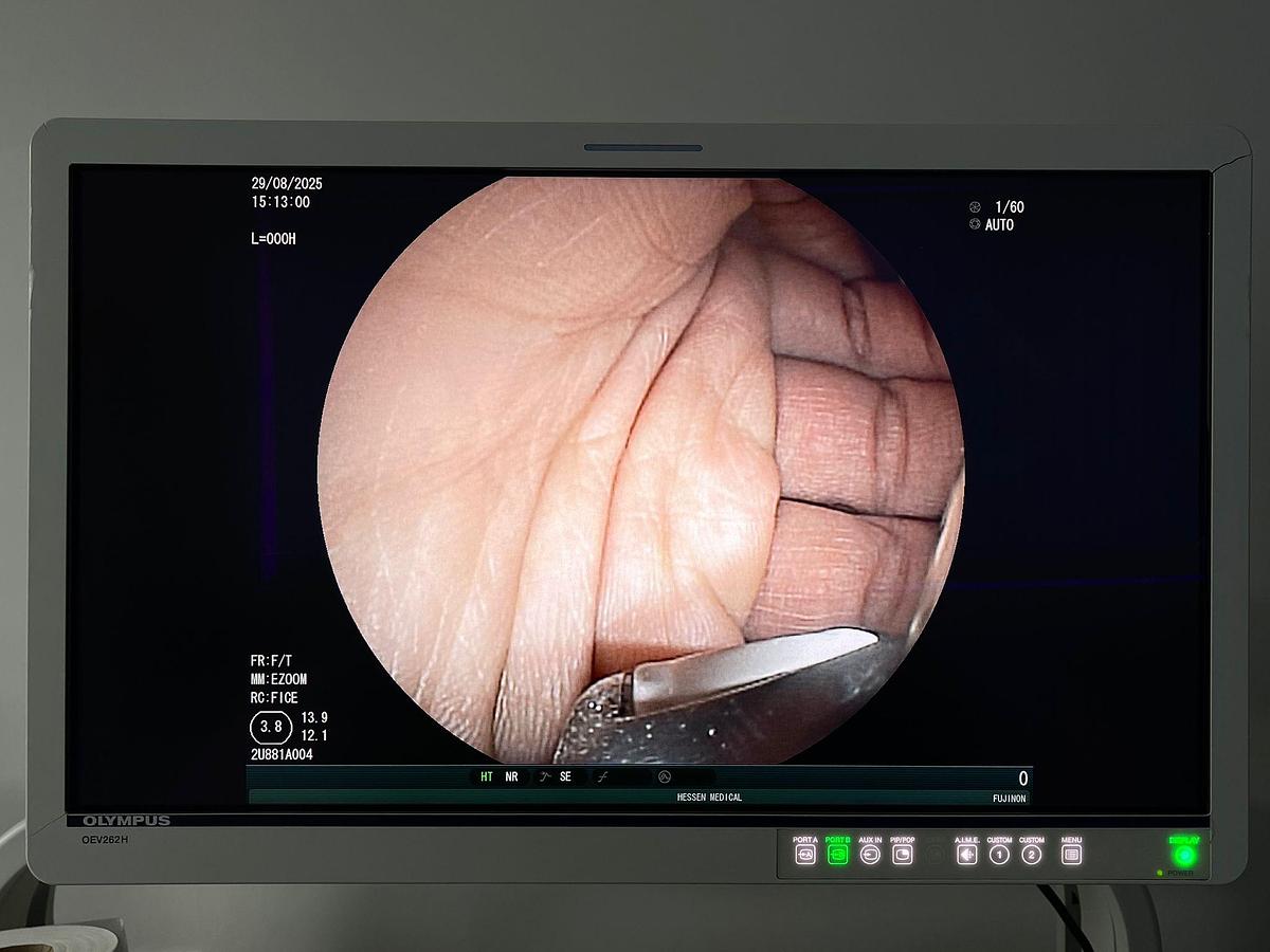 Used Fujinon Scope Model: EG-530UT YOM: 2008 