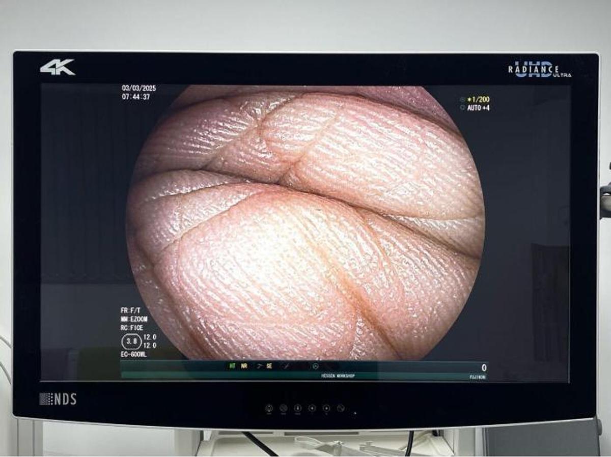 Used - FUJINON EC-600WL