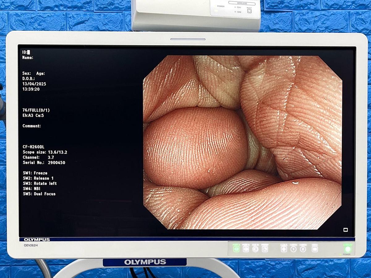 Used OLYMPUS Tower System CV-290 Endoscopy Processor