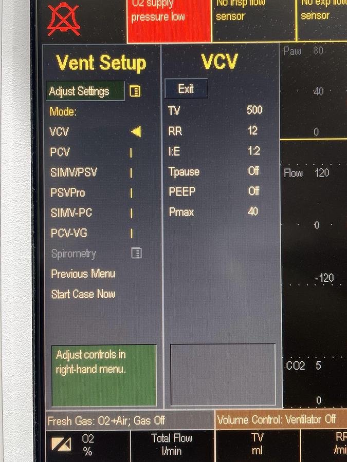 Used GE S/5 Datex-Ohmeda Anesthesia Machine (YOM: 2008)