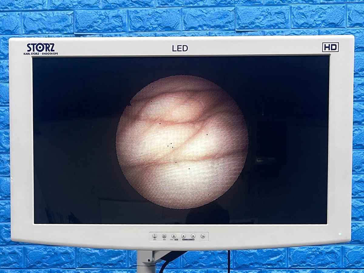 Used RICHARD WOLF 7305.006 Cystoscope Endoscopy Scope