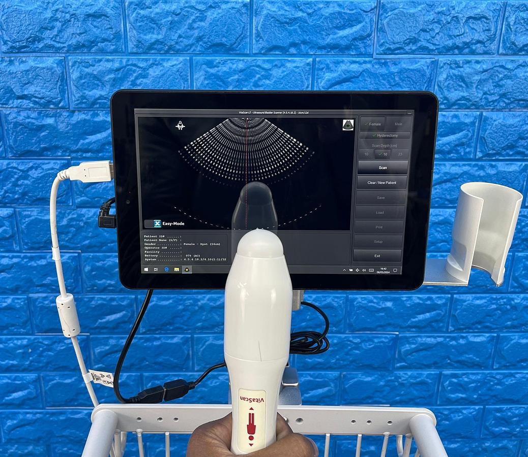 Used Vitacon VitaScan LT Urology Ultrasound With Vitascan V2 Probe.