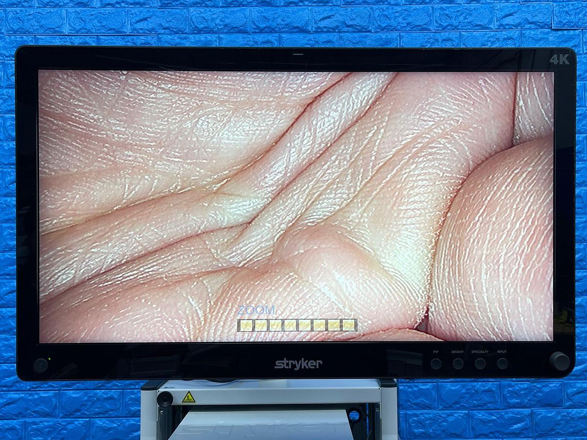 Used Stryker 1588 Laparoscopy Tower - Stryker 1588 Laparoscopy Tower  - Stryker Led Monitor 32 inch 4K YOM: 2016 - Pneumo Care - Synk Wireless Transmitter  - 1588 HD Camera Head  - SDC3 HD Information Management YOM: 2013 - 1588 HD Image Processor YOM: 2016 - LIO LED Light Source YOM: 2016 - SDP 1000 Digital Colour Printer