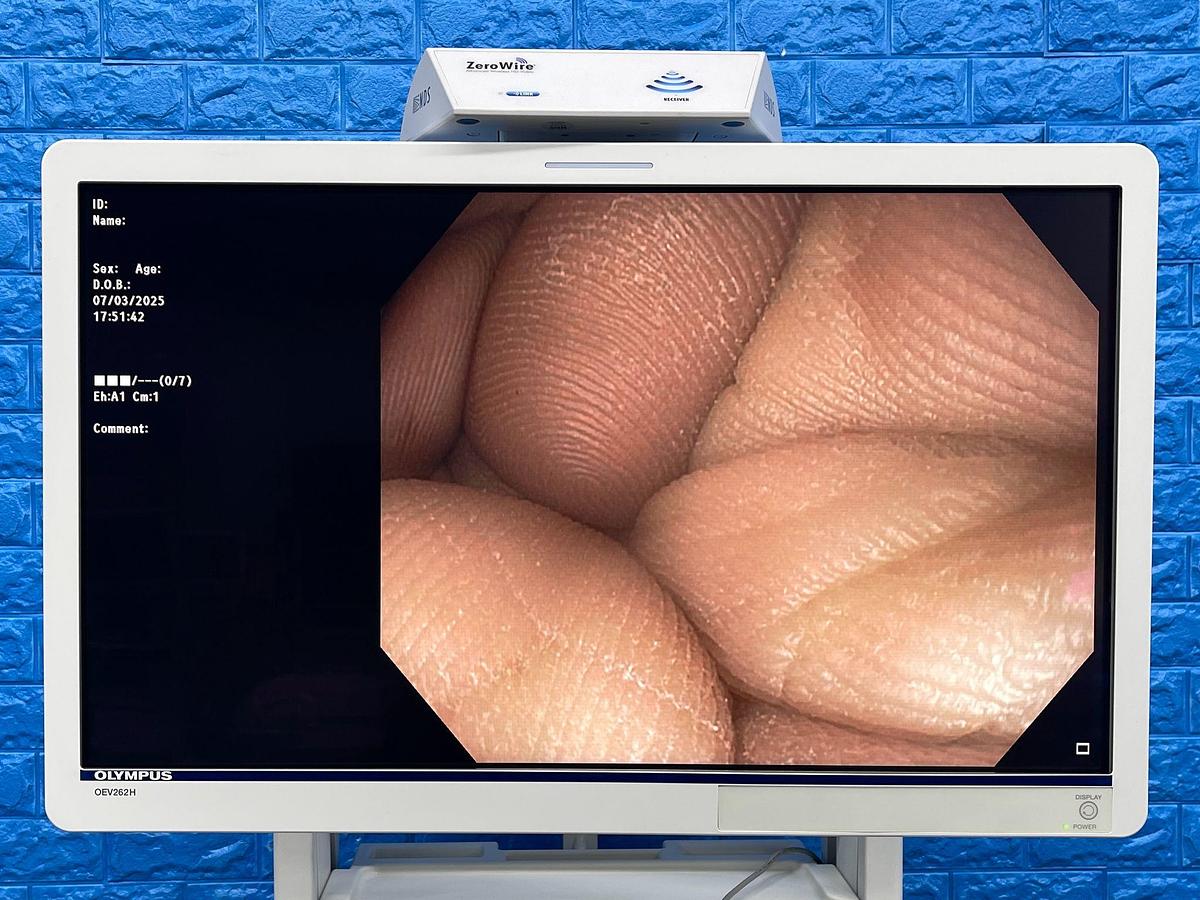 Used Olympus System Evis Exera III, Model: CV-190