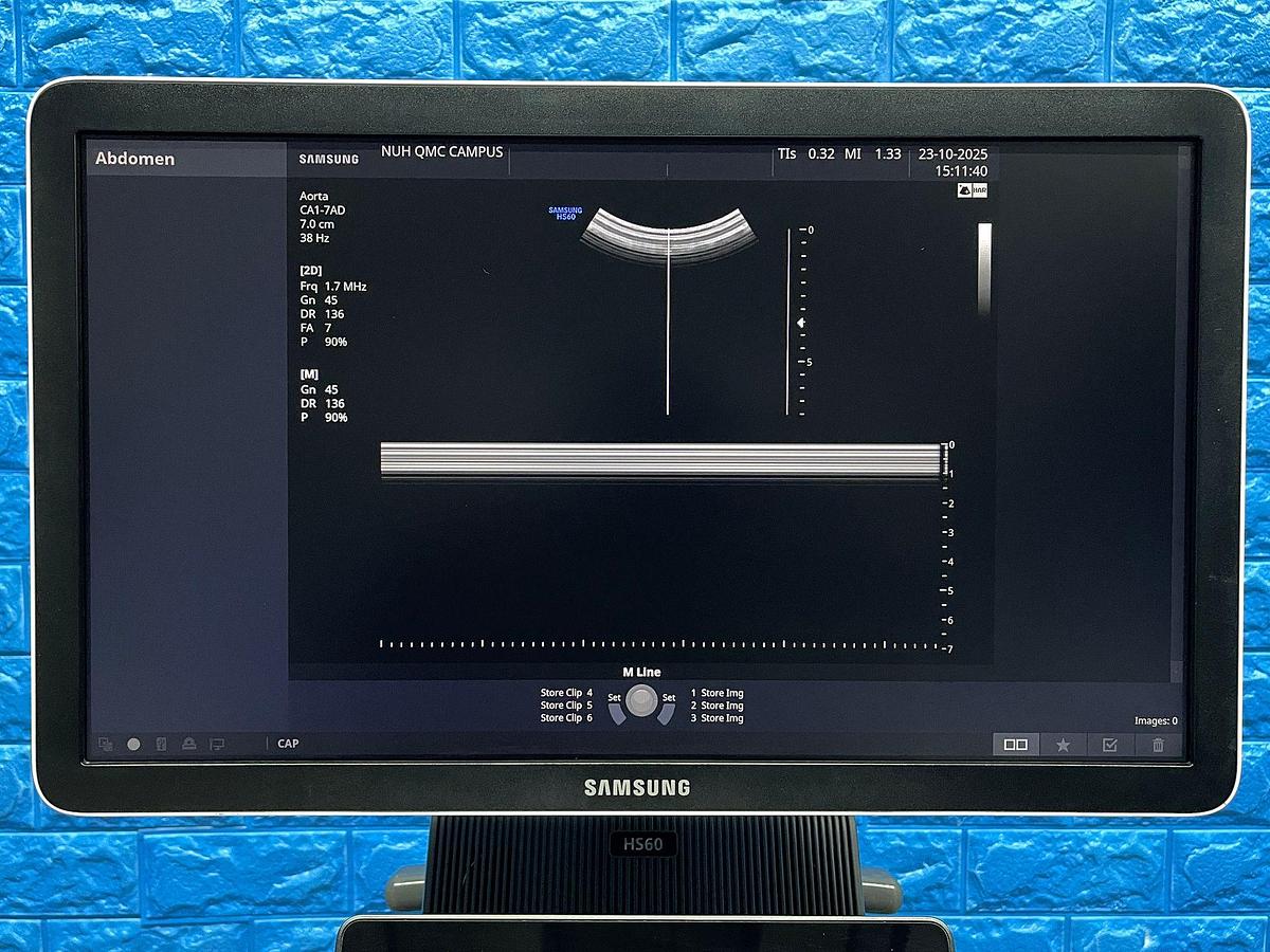 Used Samsung HS 60 Ultrasound  YOM: 2018 