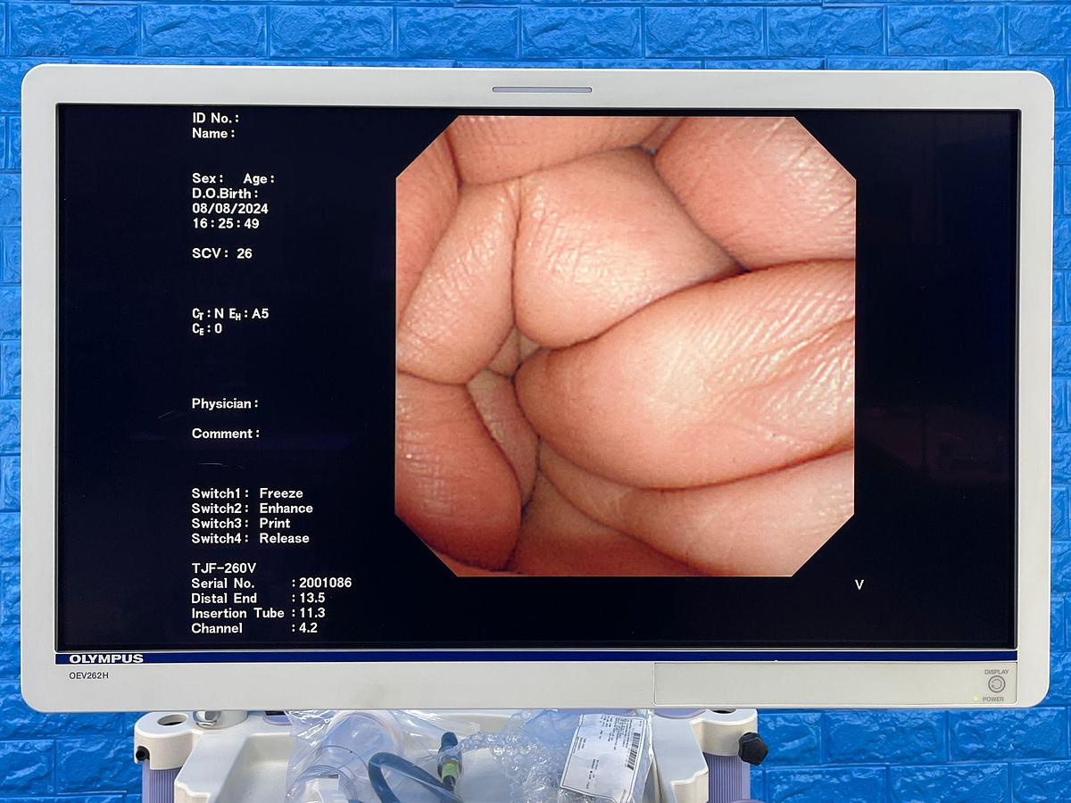 Used Olympus TJF 260V Duodenoscope