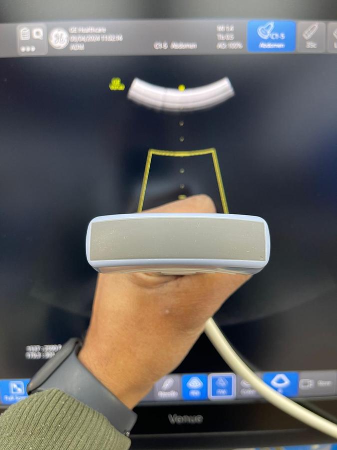 Used GE Venue R1 YOM: 2018 With 3 Probes.