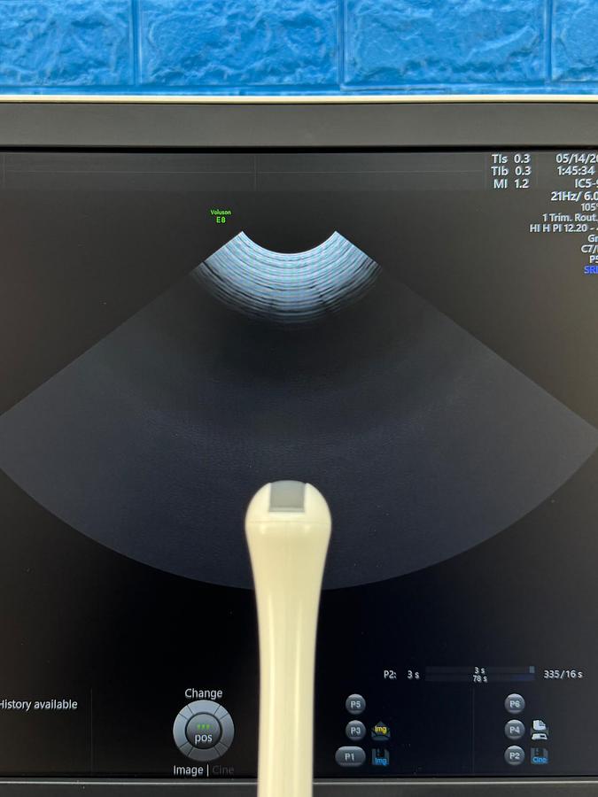 Used GE Voluson E8 Ultrasound YOM: 2019  