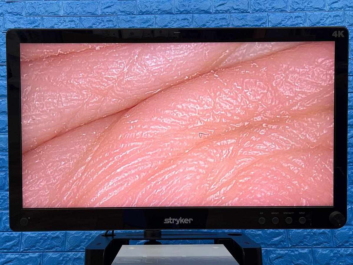 Used Stryker 1688 4K Tower