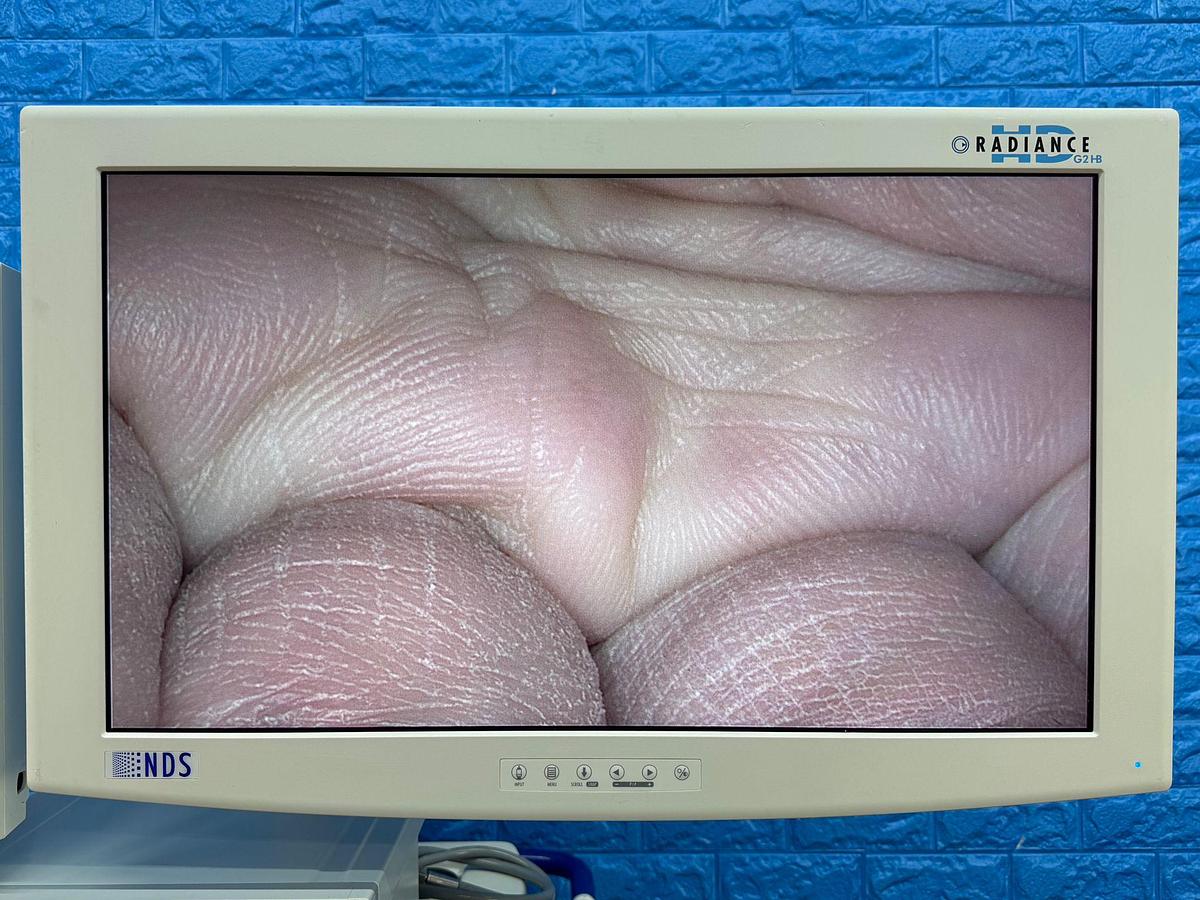 Used Karl Storz Spies Tower: -LCD Monitor 26 Inch  -Aida Monitor 19 Inch Touch Screen -Endoflator with Hose  -Keyboard -Camera Head H3-Z Spies S Full HD TH100  -Aida Control WD 200 -Xenon 300 Light source  -Spies S TC200/TC300 -Sony Printer