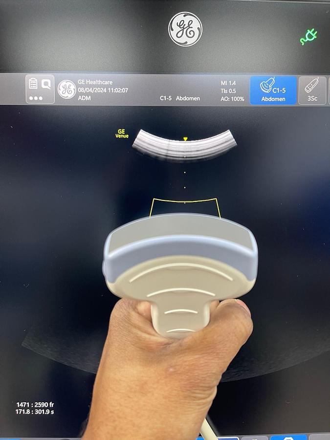 Used GE Venue YOM: 2018 With 3 Probes.