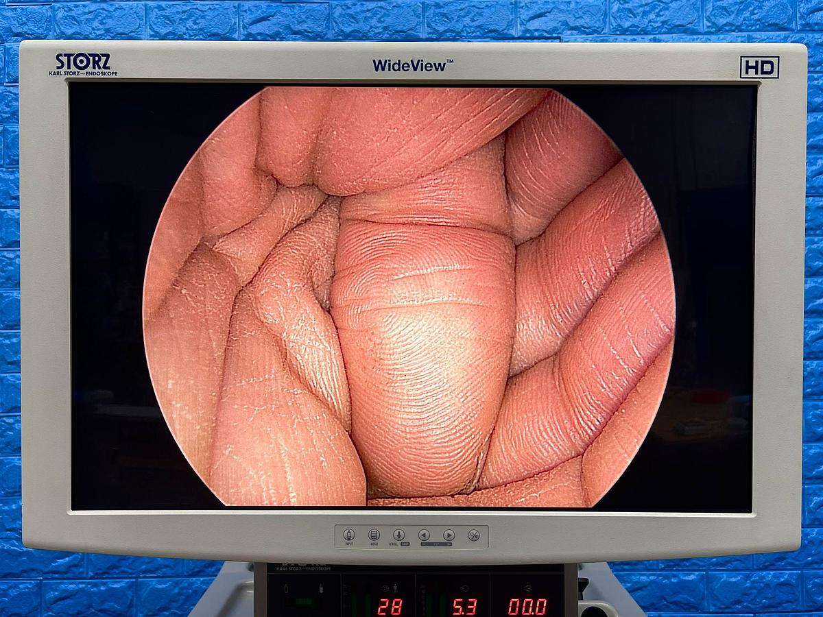 Used Karl Storz Laparoscopy Tower Karl Storz 24Inch LCD Monitor  Karl Storz Endoflator  Karl Storz Xenon 300 Karl Storz Image 1 Hub Karl Storz H3 Camera Head