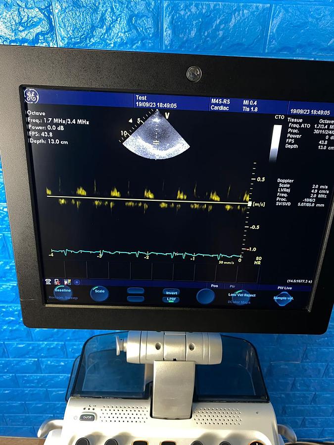 Used GE Vivid S6 Cardiovascular ultrasound system YOM: 2013