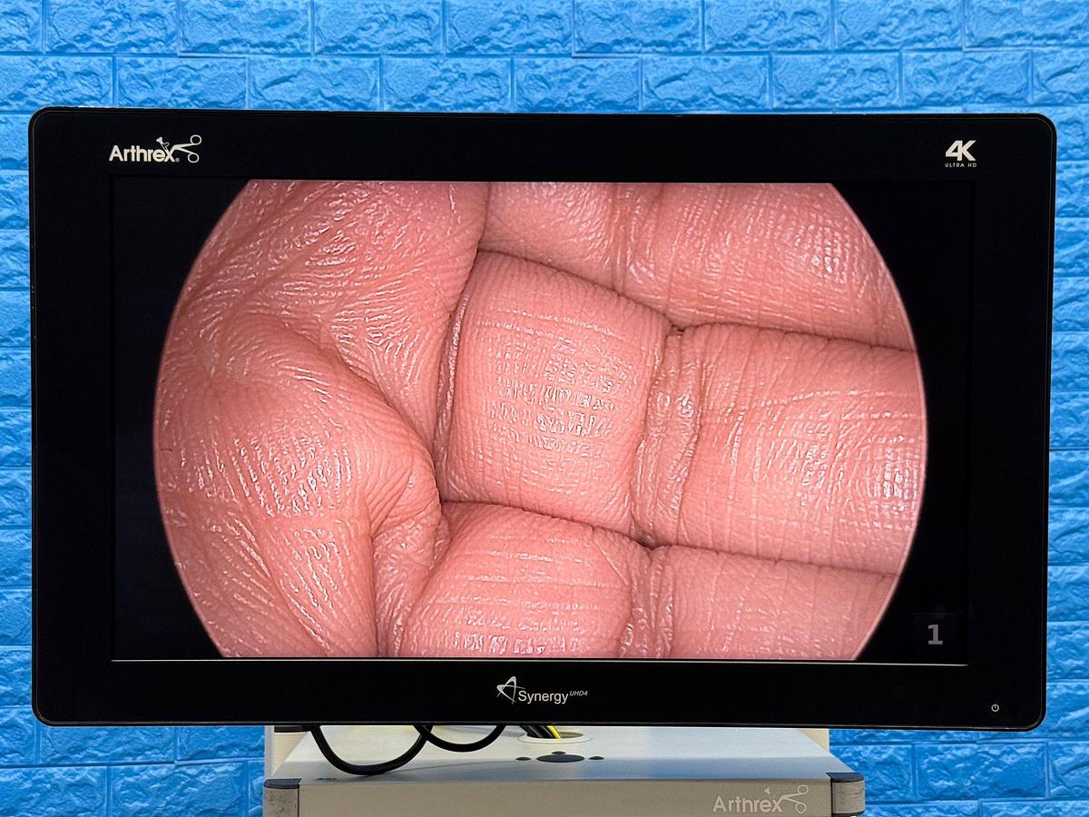 Used Arthrex 4K Laparoscopy Tower - LED 4K Monitor 32 inch YOM: 2018  - Synergy UHD4 4K Vision LED Image Processor  - Arthrex 4K Ultra Autoclave Camera Head    - Karl Storz Endoflator   - Arthrex Trolley