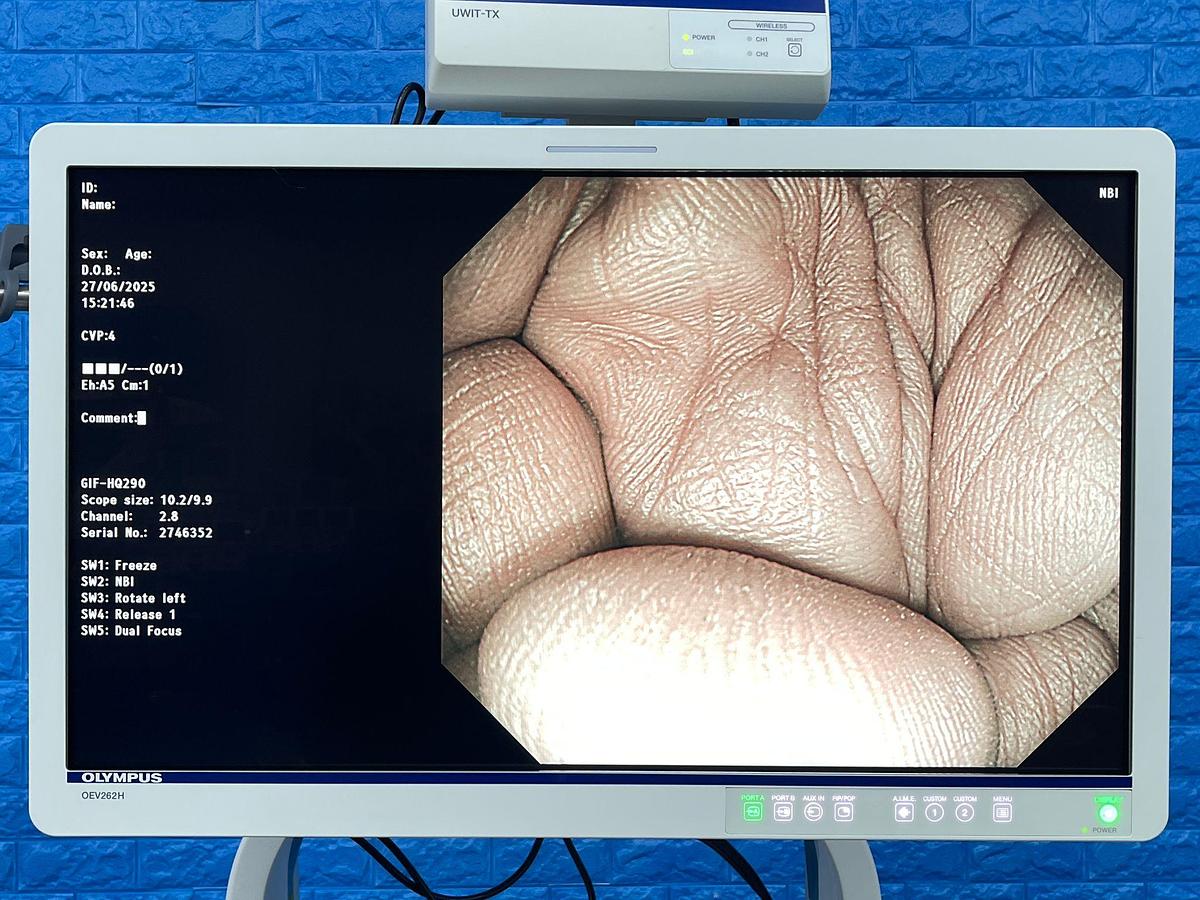 Used Olympus GIF-HQ290 Gastroscope