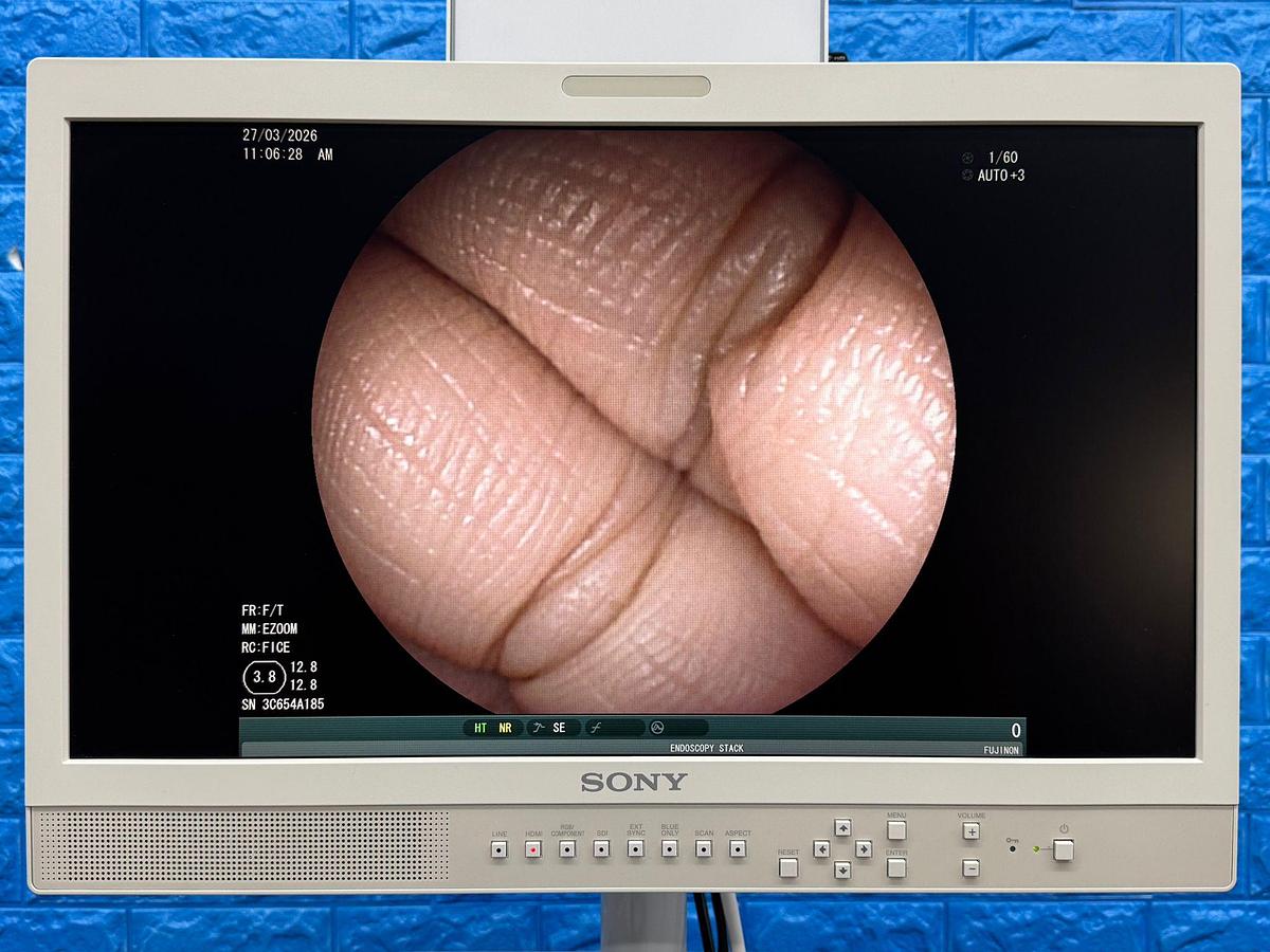 Used Fujinon Scope Model: EC-530FL 