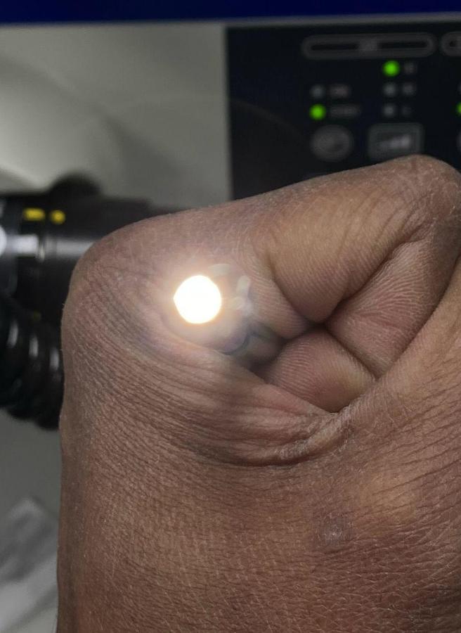 Used Olympus scope Mode: GIF-N180