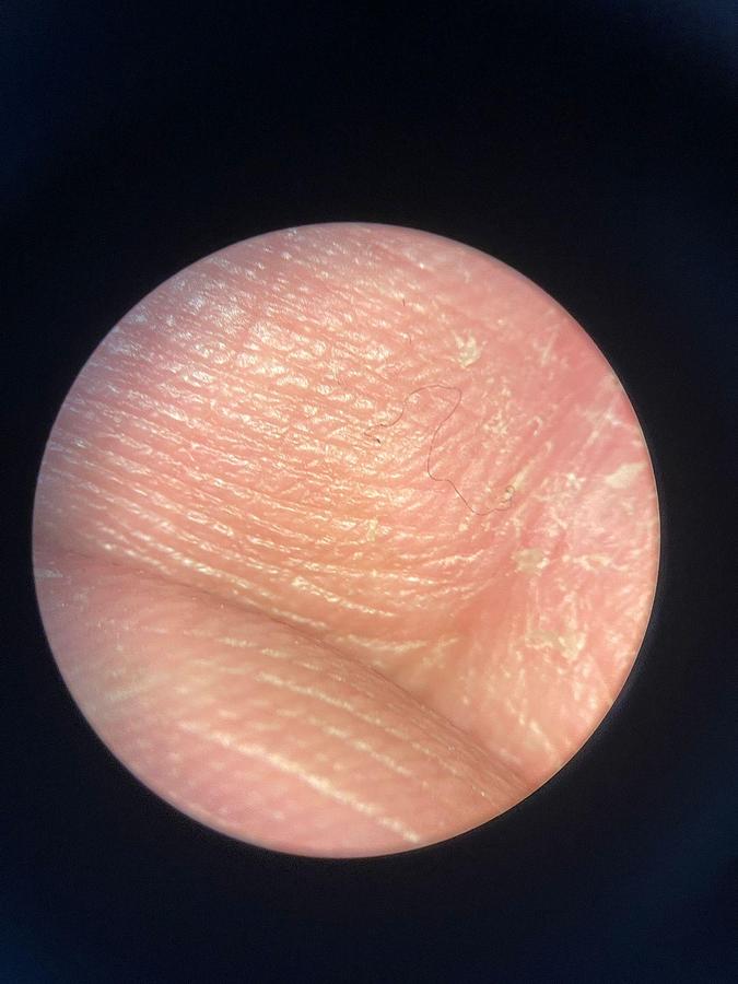 Used ZEISS S7 OPMI Movena Microscope YOM: 2009