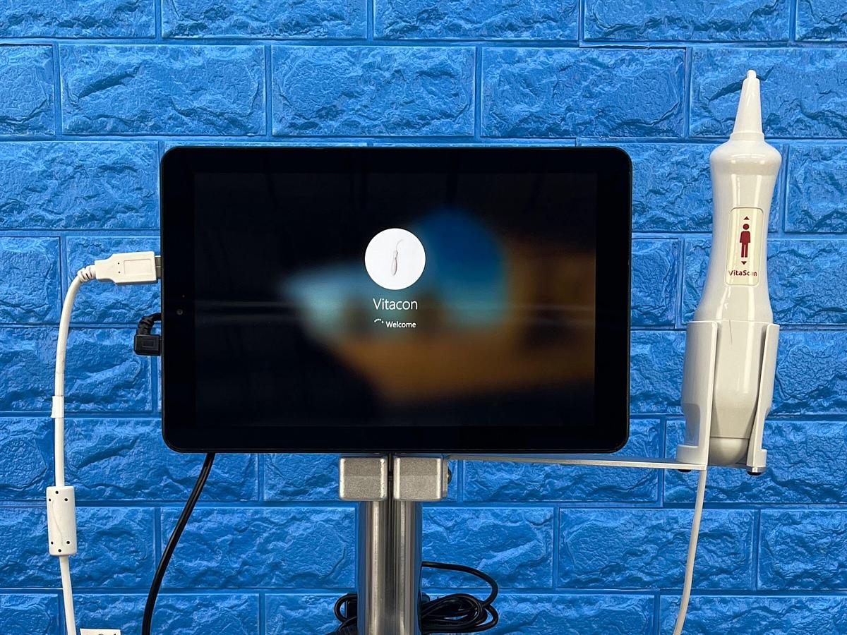 Used Vitacon VitaScan LT Urology Ultrasound With Vitascan V2 Probe.