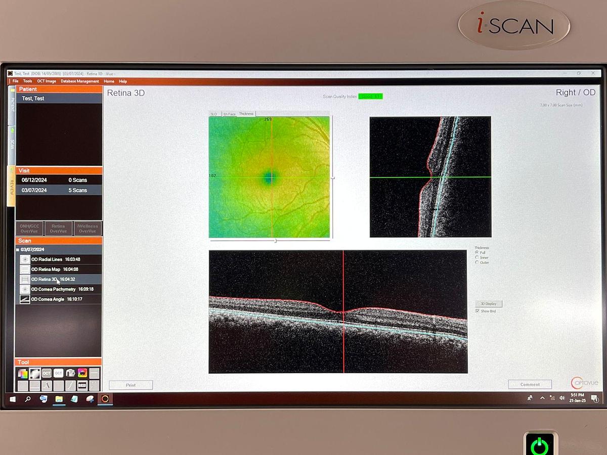 Used OPTOVUE IVUE 500 YOM: 2021 OCT