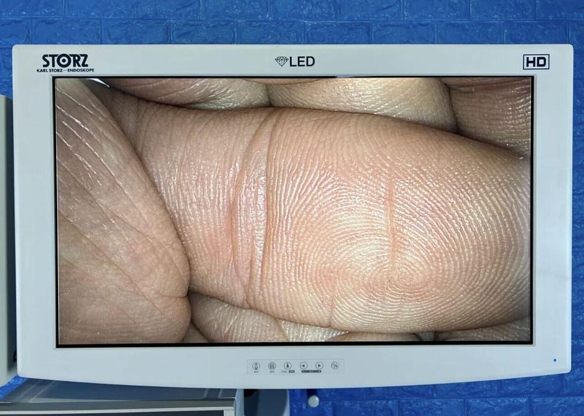 Used Karl Storz Image 1 Hub 222010 20 complete tower with Karl Storz H3-Z camera head.