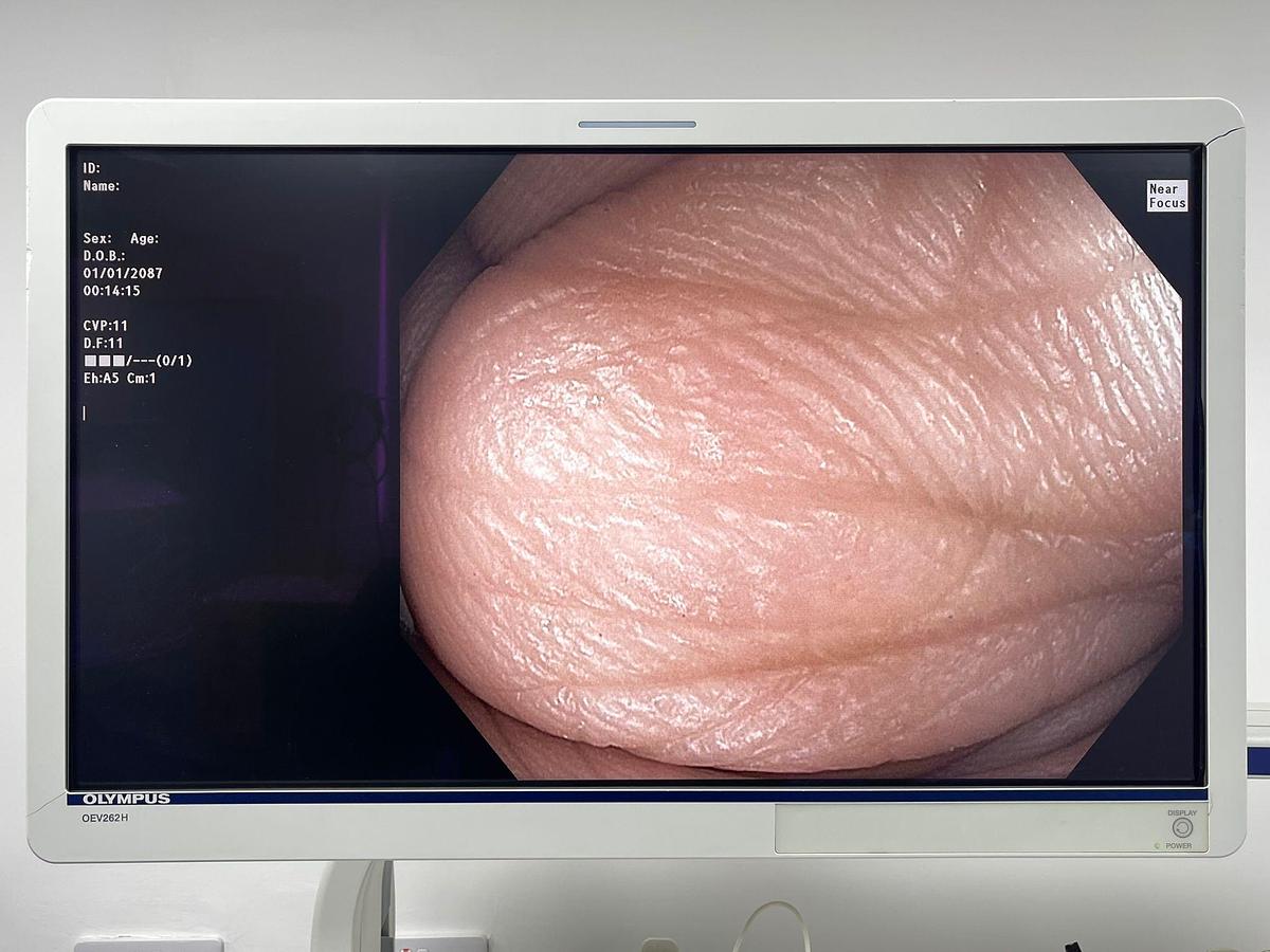 Used Olympus Scope Model: CF-HQ190L