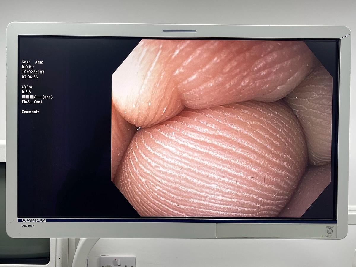 Used Olympus Scope GIF-1TH190