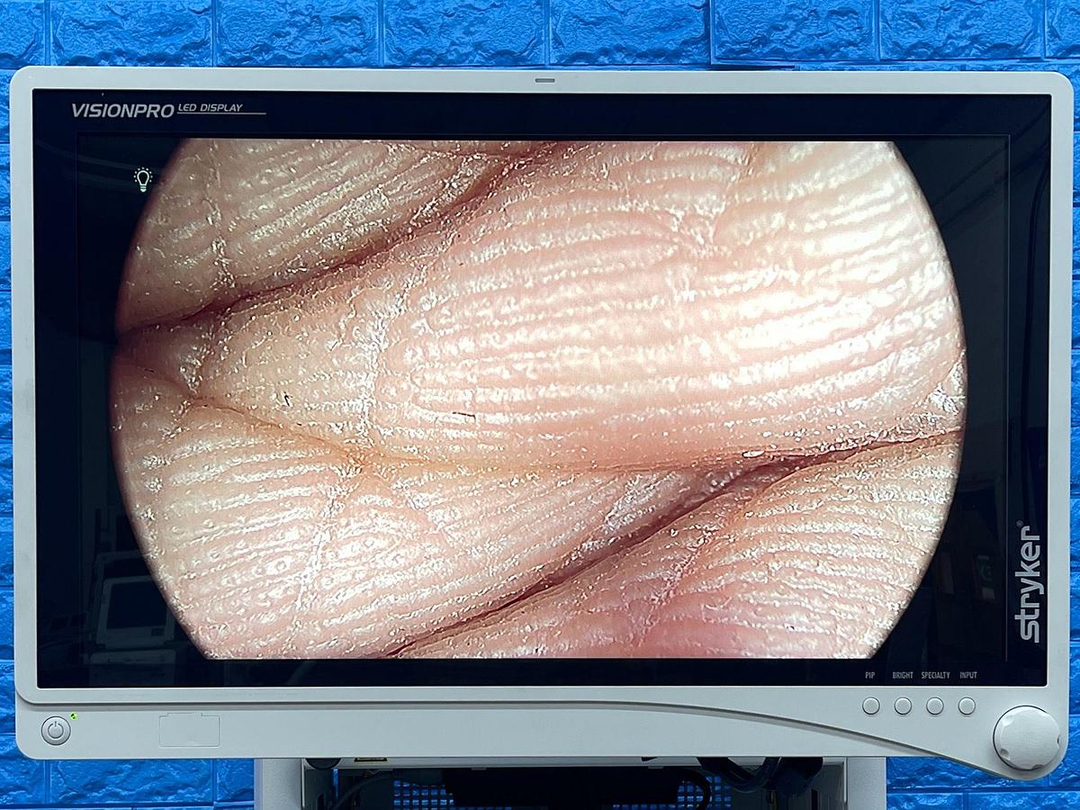 Used Stryker 1588 Tower, LCD Monitor, YOM: 2017