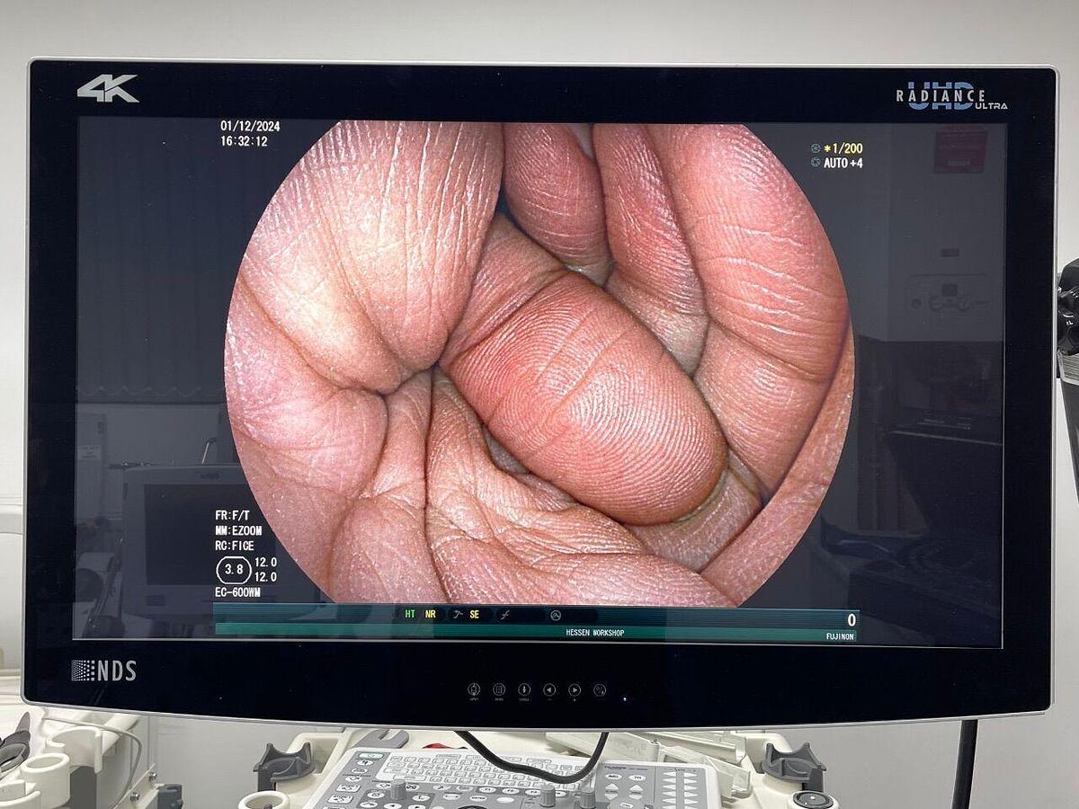 Used FUJINON EC-600WM Scope