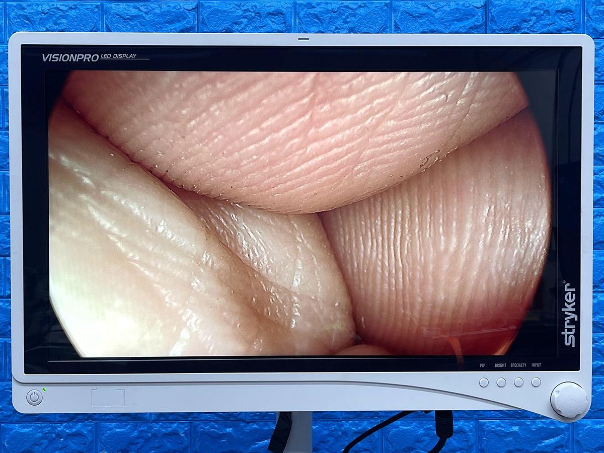 Used Stryker 1488 Tower  Lcd Monitor  YOM: 2017