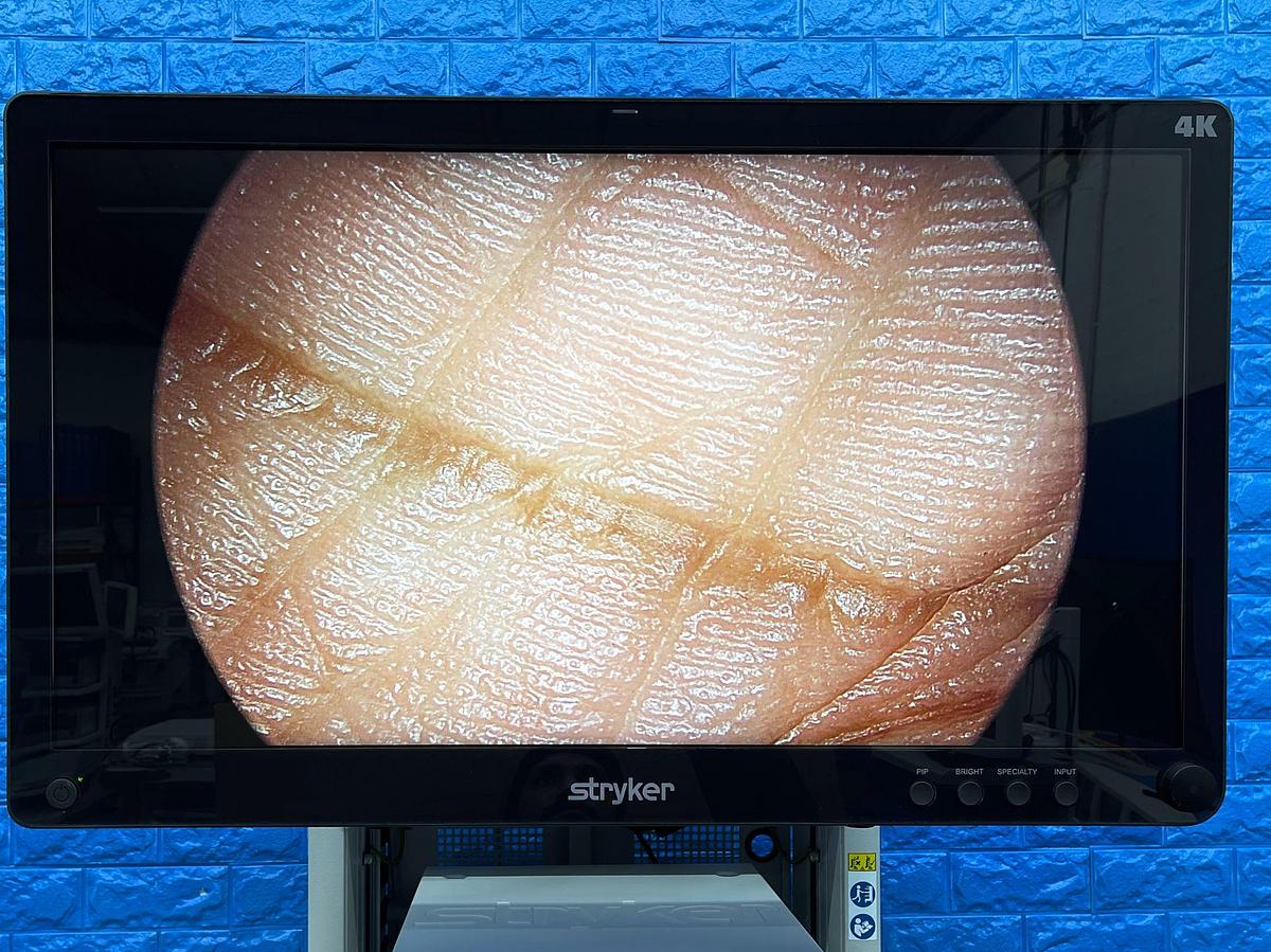 Used Stryker 1688 4K Tower  Lcd Monitor 4k 32” YOM: 2021