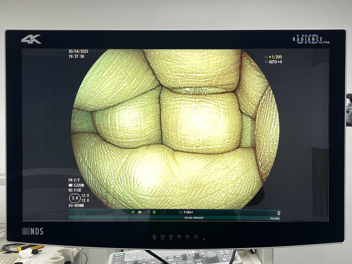 Used FUJINON Scope Model: EC-600WM Colonoscope