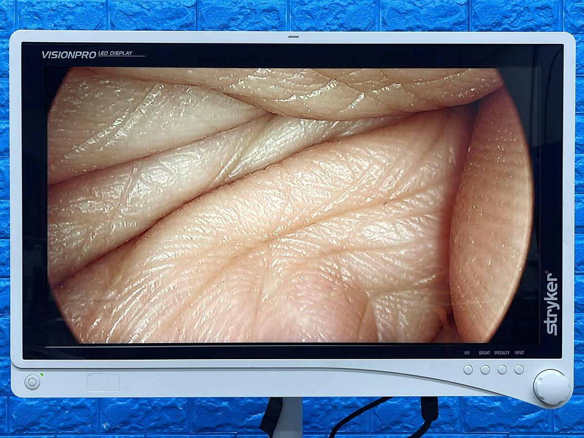 Used Stryker 1488 Tower  Lcd Monitor  YOM: 2017